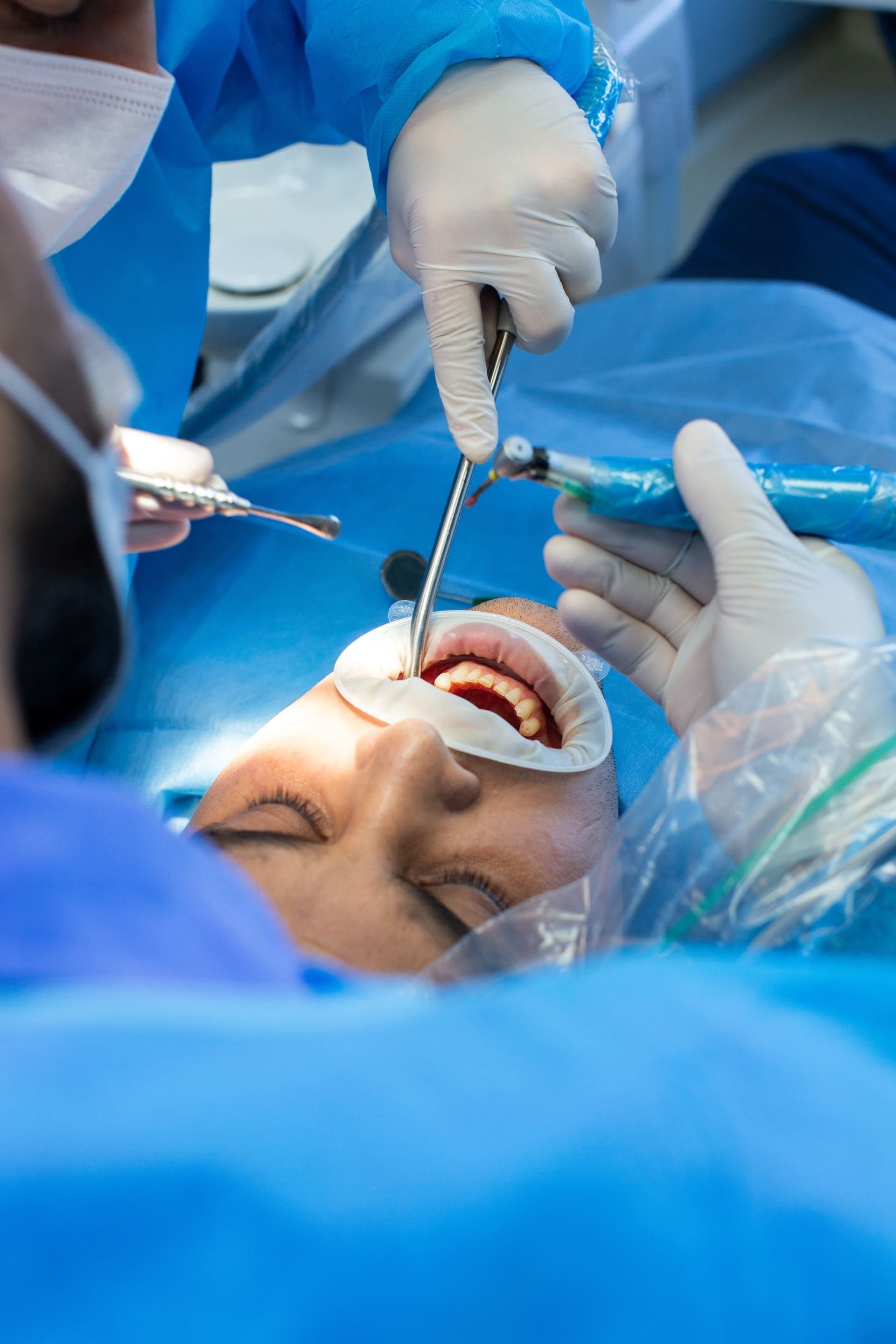 Dental surgery