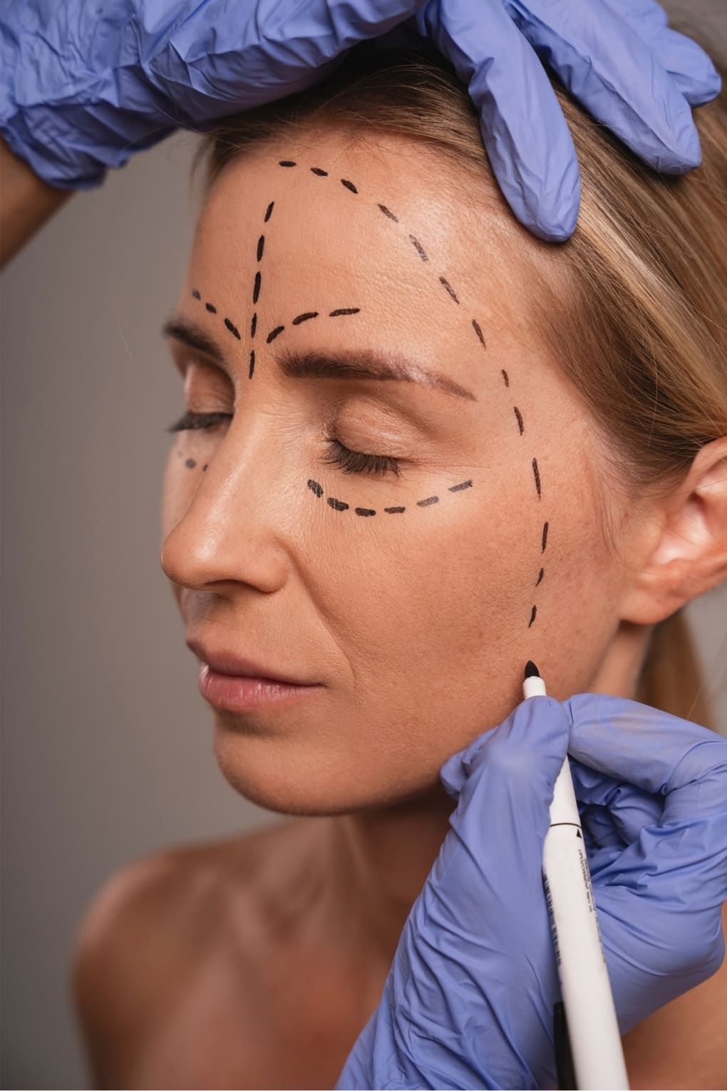 Plastic surgery